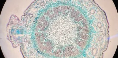 Tesis “Interacción de Fusarium circinatum y Pinus pinaster&quot;