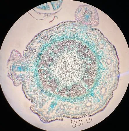 Tesis “Interacción de Fusarium circinatum y Pinus pinaster&quot;